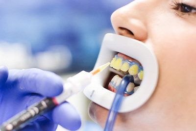 Briter Dental | Inlays  amp  Onlays, General Dentistry and Oral Exams