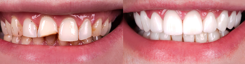 Briter Dental | Orthodontics, Oral Exams and Bone Grafts