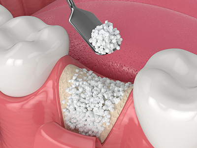 Briter Dental | General Dentistry, Orthodontics and Teeth Whitening