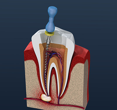 Briter Dental | Geriatric Dentistry, Dental Bridges and Oral Exams