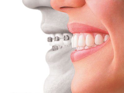 Briter Dental | Veneers, Oral Surgery and Pediatric Dentistry