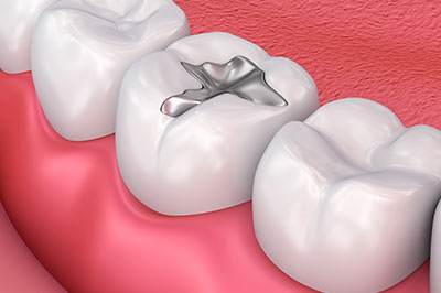 Briter Dental | Pediatric Dentistry, Geriatric Dentistry and Cosmetic Dentistry