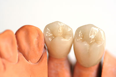 Briter Dental | TMJ Disorders, Removable Partial   Complete Dentures and General Dentistry