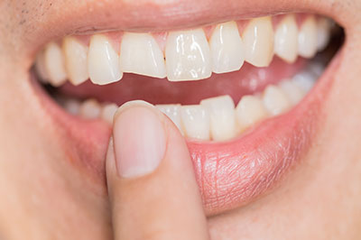 Briter Dental | Family Dentistry, Periodontal Treatment and Dentures