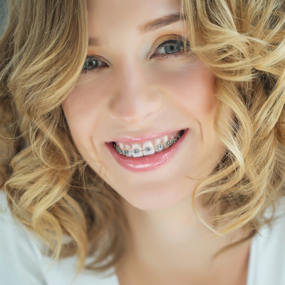 Briter Dental | Preventative Program, Dental Sealants and Dental Fillings