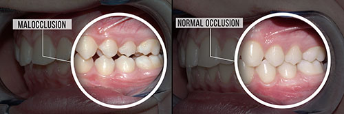 Briter Dental | Invisalign reg , Teeth Whitening and Oral Surgery