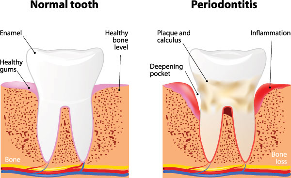 Briter Dental | Oral Surgery, Teeth Whitening and Dental Bridges
