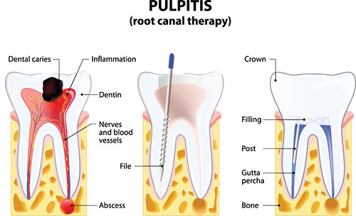 Briter Dental | Geriatric Dentistry, Dental Bridges and Oral Exams