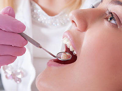 Briter Dental | Root Canals, Implant Supported Dentures and Night Guards