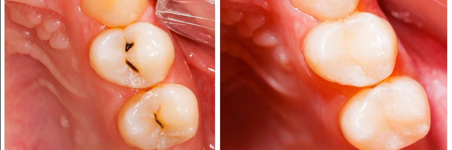 Briter Dental