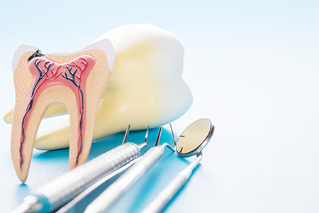 Briter Dental | Bone Grafts, Dental Fillings and Dental Bridges