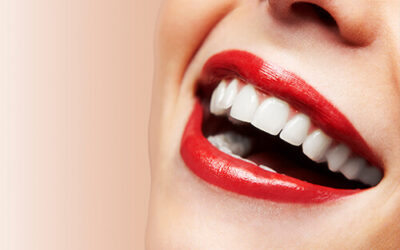 5 Secrets to a Million-Dollar Smile